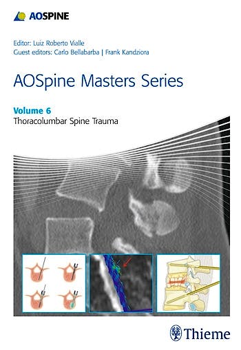 Portada del libro 9781626232259 AOSpine Masters Series, Vol. 6: Thoracolumbar Spine Trauma