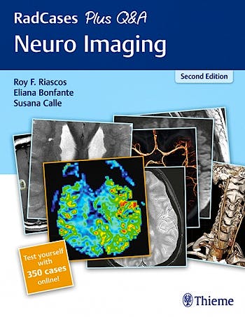 Portada del libro 9781626232372 Neuro Imaging (RadCases Plus Q&A) + 350 Cases Online
