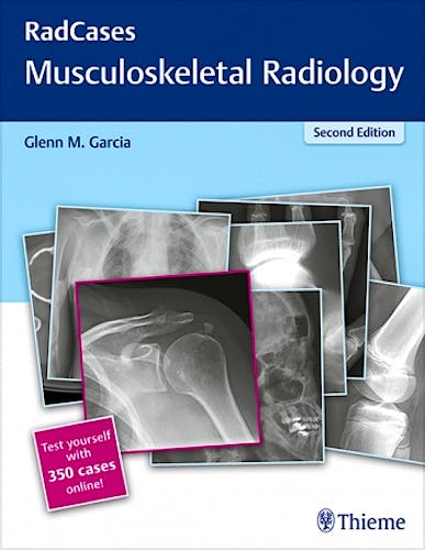 Portada del libro 9781626232440 Musculoskeletal Radiology (Radcases Series) + 350 Cases Online