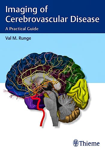 Portada del libro 9781626232488 Imaging of Cerebrovascular Disease. a Practical Guide