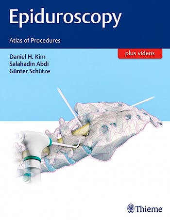 Portada del libro 9781626232662 Epiduroscopy. Atlas of Procedures