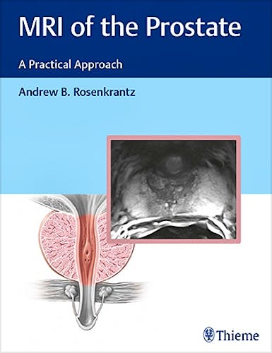 Portada del libro 9781626232686 MRI of the Prostate. A Practical Approach