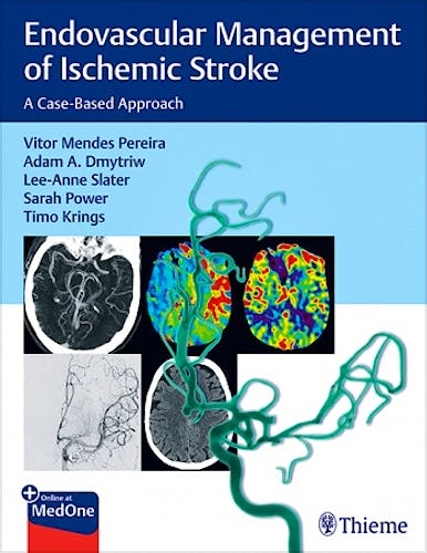 Portada del libro 9781626232754 Endovascular Management of Ischemic Stroke. A Case-Based Approach
