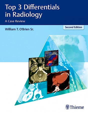 Portada del libro 9781626232785 Top 3 Differentials in Radiology. A Case Review