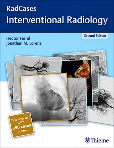 Portada del libro 9781626232822 Interventional Radiology (Radcases Series) + 350 Cases Online
