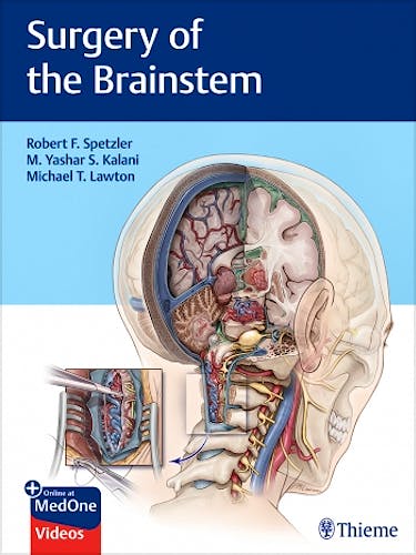 Portada del libro 9781626232914 Surgery of the Brainstem
