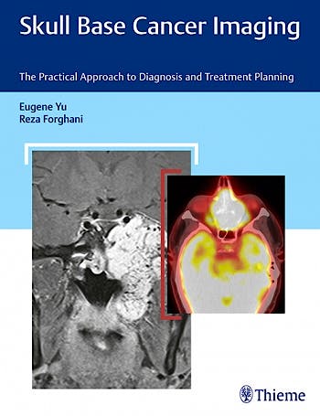 Portada del libro 9781626232969 Skull Base Cancer Imaging. The Practical Approach to Diagnosis and Treatment Planning