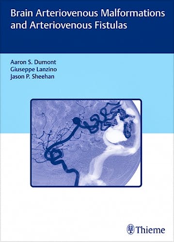 Portada del libro 9781626233225 Brain Arteriovenous Malformations and Arteriovenous Fistulas
