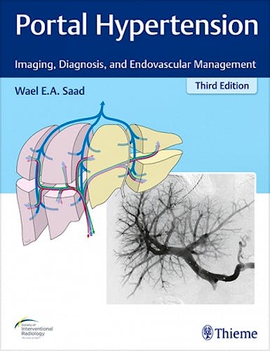 Portada del libro 9781626233270 Portal Hypertension. Imaging, Diagnosis and Endovascular Management