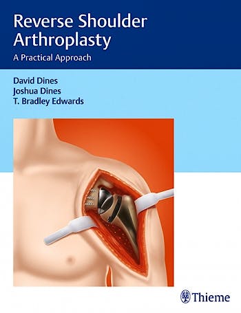 Portada del libro 9781626233607 Reverse Shoulder Arthroplasty. A Practical Approach