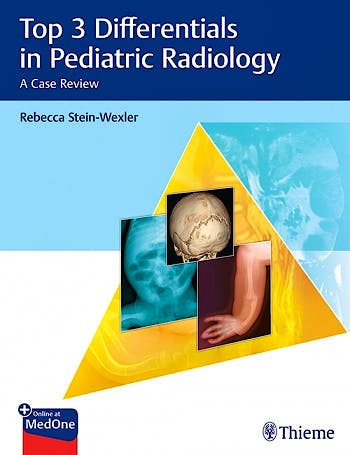 Portada del libro 9781626233706 Top 3 Differentials in Pediatric Radiology. A Case Review