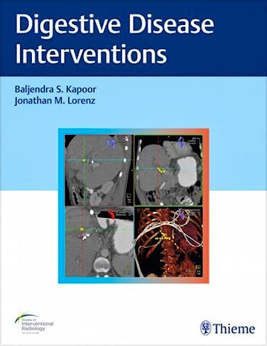 Portada del libro 9781626233744 Digestive Disease Interventions