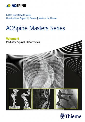 Portada del libro 9781626234536 AOSpine Masters Series, Vol. 9: Pediatric Spinal Deformities