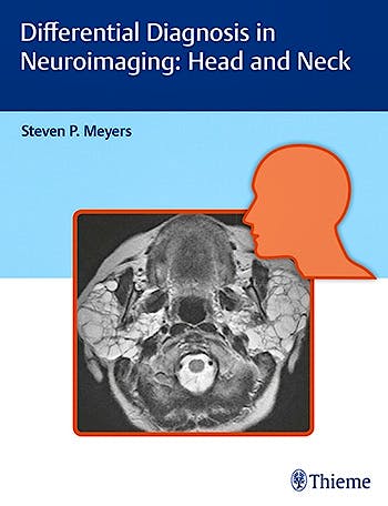 Portada del libro 9781626234758 Differential Diagnosis in Neuroimaging: Head and Neck