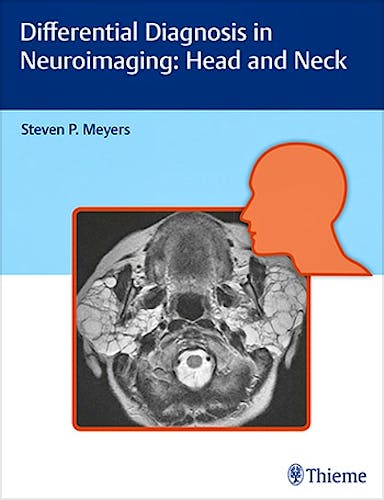 Portada del libro 9781626234758 Differential Diagnosis in Neuroimaging: Head and Neck