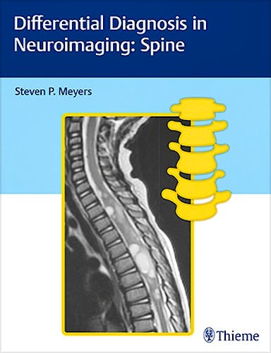 Portada del libro 9781626234772 Differential Diagnosis in Neuroimaging: Spine