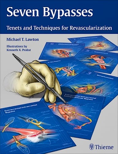 Portada del libro 9781626234833 Seven Bypasses. Tenets and Techniques for Revascularization