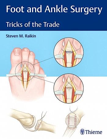 Portada del libro 9781626234918 Foot and Ankle Surgery. 	Tricks of the Trade