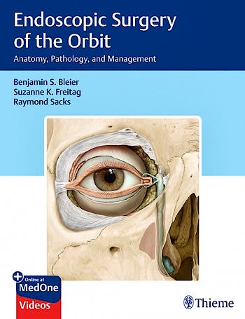 Portada del libro 9781626235052 Endoscopic Surgery of the Orbit. Anatomy, Pathology, and Management
