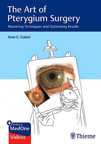 Portada del libro 9781626235113 The Art of Pterygium Surgery. Mastering Techniques and Optimizing Results