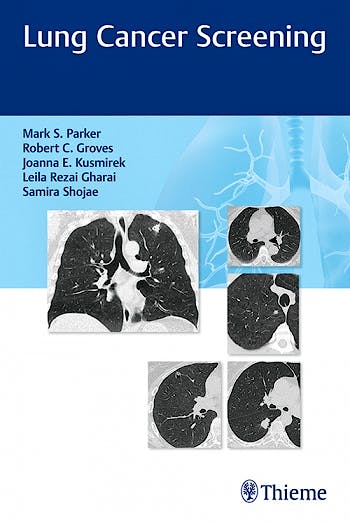 Portada del libro 9781626235137 Lung Cancer Screening
