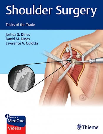 Portada del libro 9781626235168 Shoulder Surgery. Tricks of the Trade