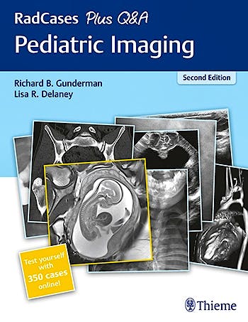 Portada del libro 9781626235199 Pediatric Imaging (RadCases Plus Q&A) + 350 Cases Online