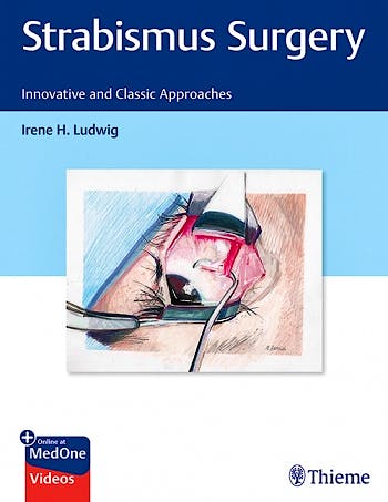Portada del libro 9781626235267 Strabismus Surgery. Innovative and Classic Approaches