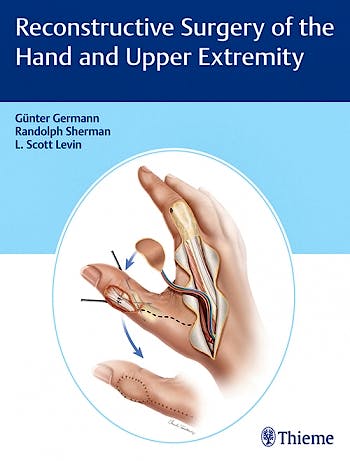 Portada del libro 9781626236011 Reconstructive Surgery of the Hand and Upper Extremity