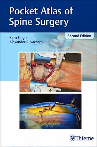 Portada del libro 9781626236233 Pocket Atlas of Spine Surgery