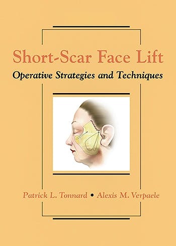 Portada del libro 9781626236325 Short-Scar Face Lift. Operative Strategies and Techniques