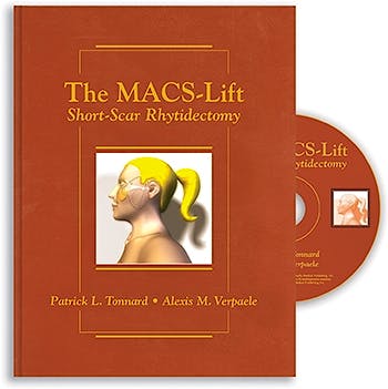 Portada del libro 9781626236332 The MACS-Lift. Short-Scar Rhytidectomy