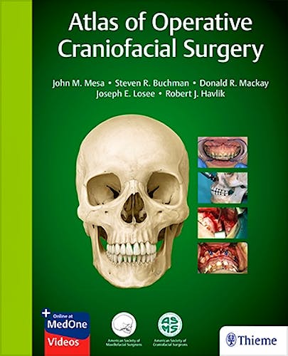 Portada del libro 9781626236707 Atlas of Operative Craniofacial Surgery
