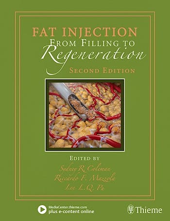 Portada del libro 9781626236752 Fat Injection. From Filling to Regeneration + E-Content Online.