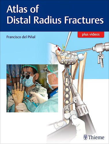 Portada del libro 9781626236790 Atlas of Distal Radius Fractures + Videos