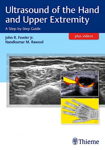 Portada del libro 9781626236882 Ultrasound of the Hand and Upper Extremity. A Step-by-Step Guide + Videos Online