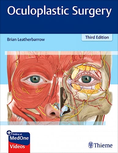Portada del libro 9781626236899 Oculoplastic Surgery