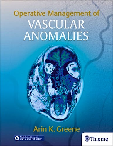 Portada del libro 9781626236905 Operative Management of Vascular Anomalies