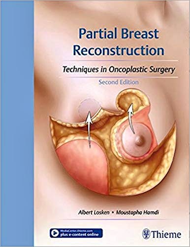 Portada del libro 9781626236912 Partial Breast Reconstruction. Techniques in Oncoplastic Surgery
