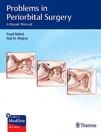 Portada del libro 9781626237087 Problems in Periorbital Surgery. A Repair Manual