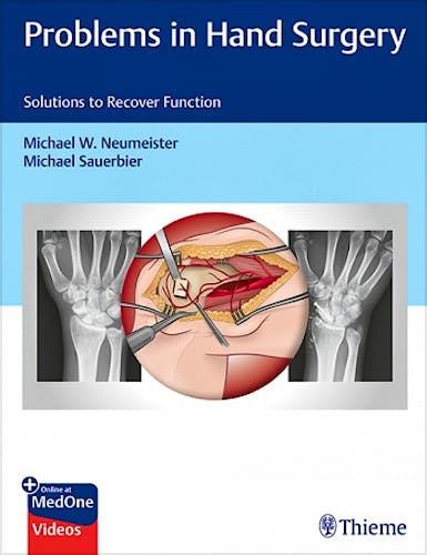 Portada del libro 9781626237094 Problems in Hand Surgery. Solutions to Recover Function