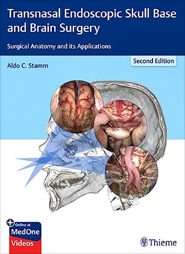 Portada del libro 9781626237100 Transnasal Endoscopic Skull Base and Brain Surgery. Surgical Anatomy and Its Applications