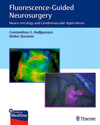 Portada del libro 9781626237148 Fluorescence-Guided Neurosurgery. Neuro-Oncology and Cerebrovascular Applications + Online at MedOne