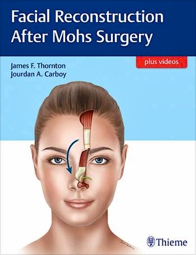 Portada del libro 9781626237346 Facial Reconstruction After Mohs Surgery + Videos