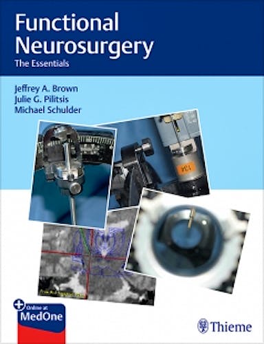 Portada del libro 9781626237742 Functional Neurosurgery. The Essentials