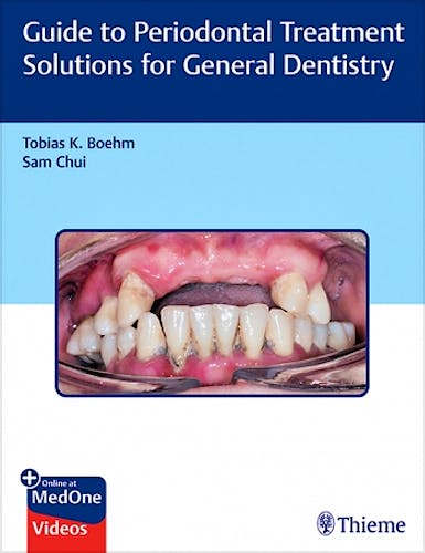 Portada del libro 9781626238008 Guide to Periodontal Treatment Solutions for General Dentistry