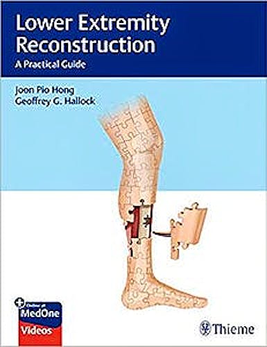 Portada del libro 9781626238084 Lower Extremity Reconstruction. A Practical Guide