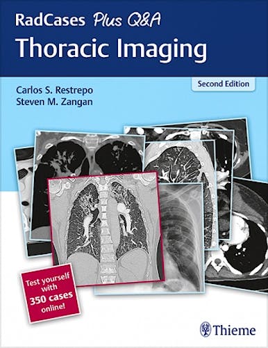 Portada del libro 9781626238145 Thoracic Imaging (RadCases Plus Q&A) + 350 Cases Online