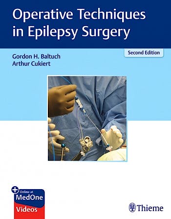 Portada del libro 9781626238183 Operative Techniques in Epilepsy Surgery + Online at MedOne