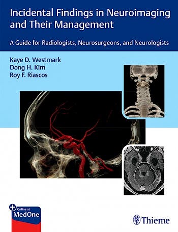 Portada del libro 9781626238282 Incidental Findings in Neuroimaging and Their Management. A Guide for Radiologists, Neurosurgeons, and Neurologists